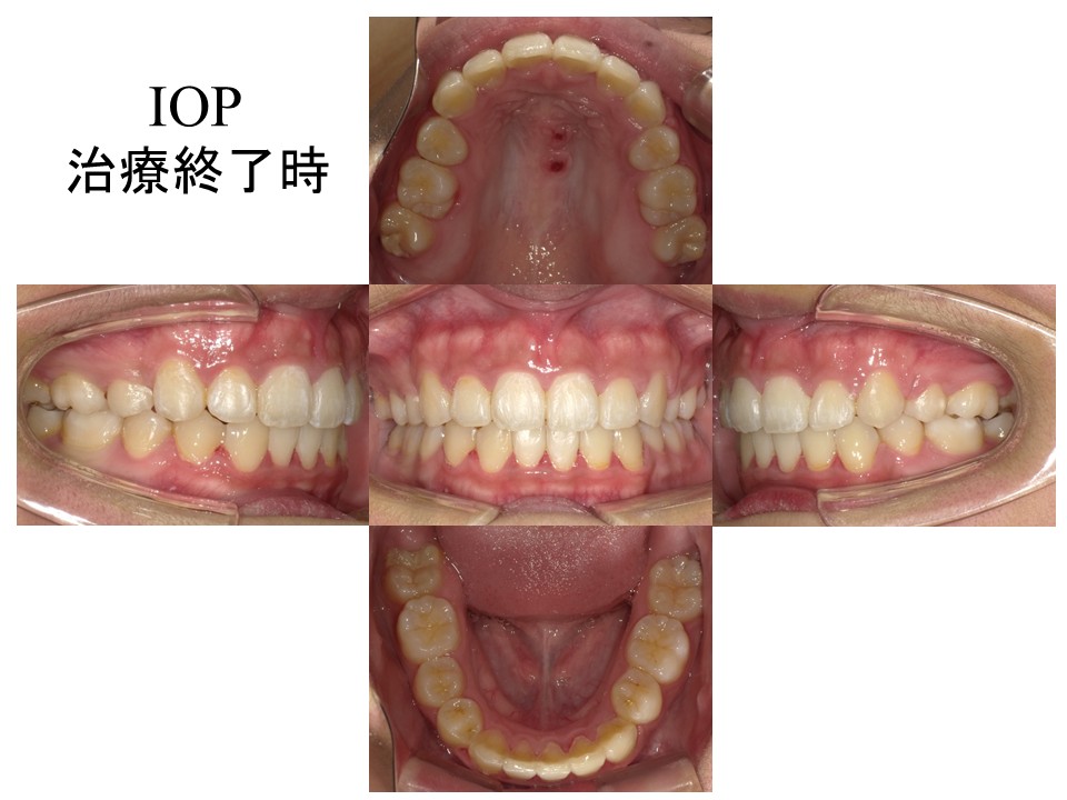 画像に alt 属性が指定されていません。ファイル名: %E3%82%B9%E3%83%A9%E3%82%A4%E3%83%894-6.jpg